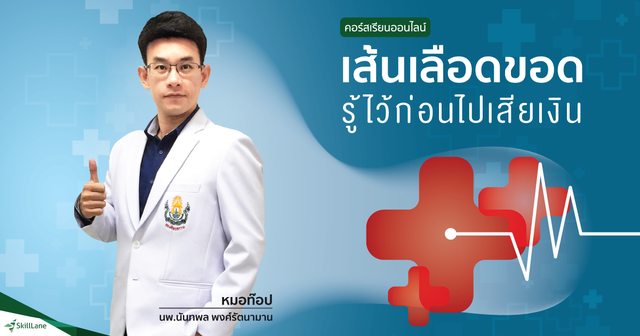 เส้นเลือดขอด รู้ไว้ก่อนไปเสียเงิน