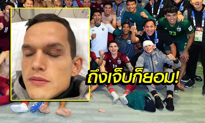 เจ็บเพื่อชาติ! "มิก้า" สุดภูมิใจแม้เปลือกตาแตกต้องออกจากสนาม (อัลบั้ม)
