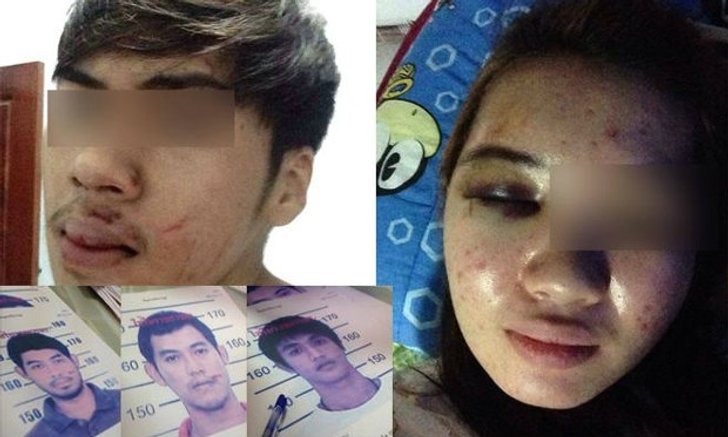 สุดโหด!แฉ 3 แข้งดังรุมทำร้ายวัยรุ่นแต่เรื่องเงียบกว่า4เดือน
