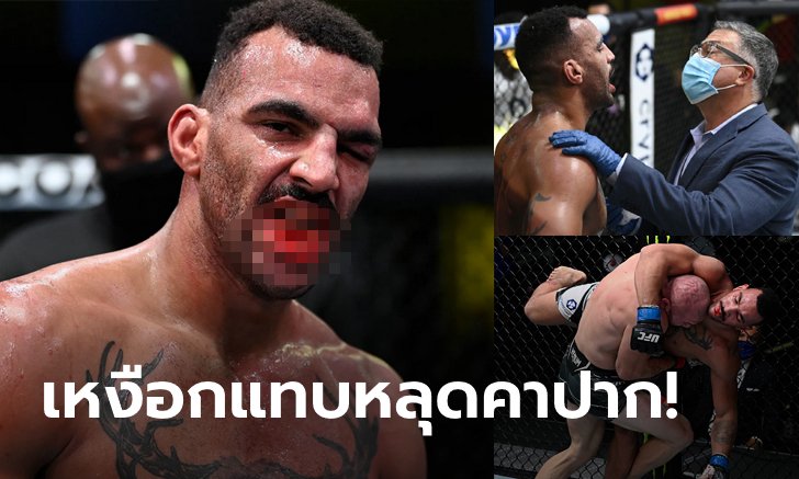 สยองได้อีก! "คลาร์ก" โชว์ฟันกับเหงือกสุดเละเทะไฟต์พ่าย "คูเตลาบา" (ภาพ)