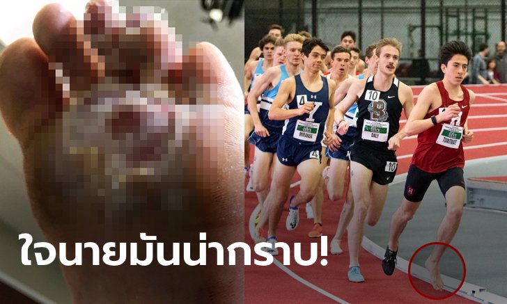 ยอดมนุษย์! เผย "คีริน" ทนวิ่งเท้าเปล่าจนแผลเหวอะก่อนซิวที่ 1 ชิงแชมป์มหาวิทยาลัย (ภาพ+คลิป)