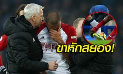 ผมไม่ได้ตั้งใจ! "รอนดอน" ร่ำไห้หนักทำ "แม็คคาร์ธี่" ขาหัก (คลิป)