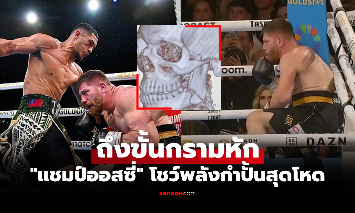 สุดช็อก! "โอเปตาย่า" จัดเปรี้ยงเดียวส่ง "ซาเคโอ" ต้องเข้ารับการผ่าตัดฉุกเฉิน (คลิป)