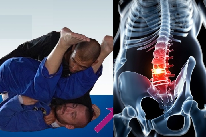 herniated-discs-bjj
