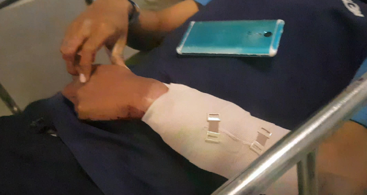 ปูพรมล่าตัว! โจรแสบฟันแขนเด็กปั๊มก่อนชิงเงินแสนหนีลอยนวล