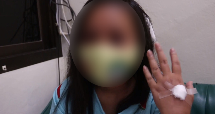 ซ้อมยับ! สาวโร่แจ้งความถูกอดีตหนุ่มร่วมงาน ล่อลวงกระหน่ำตีปางตาย