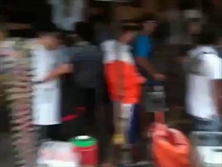 กลนิ้วขาดน้องเท็น