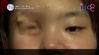 Let Me In โรงพยาบาลไอดี ศัลยกรรมเกาหลี : สาวหน้าครึ่งเสี้ยว ! ใบหน้าอีกข้างหนึ่งเกิดขึ้นกับเธอแล้ว!?