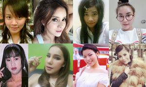 สาวไทย ศัลยกรรมหน้าใหม่ไกลถึงเกาหลี ใครเกิด ใครดับ!