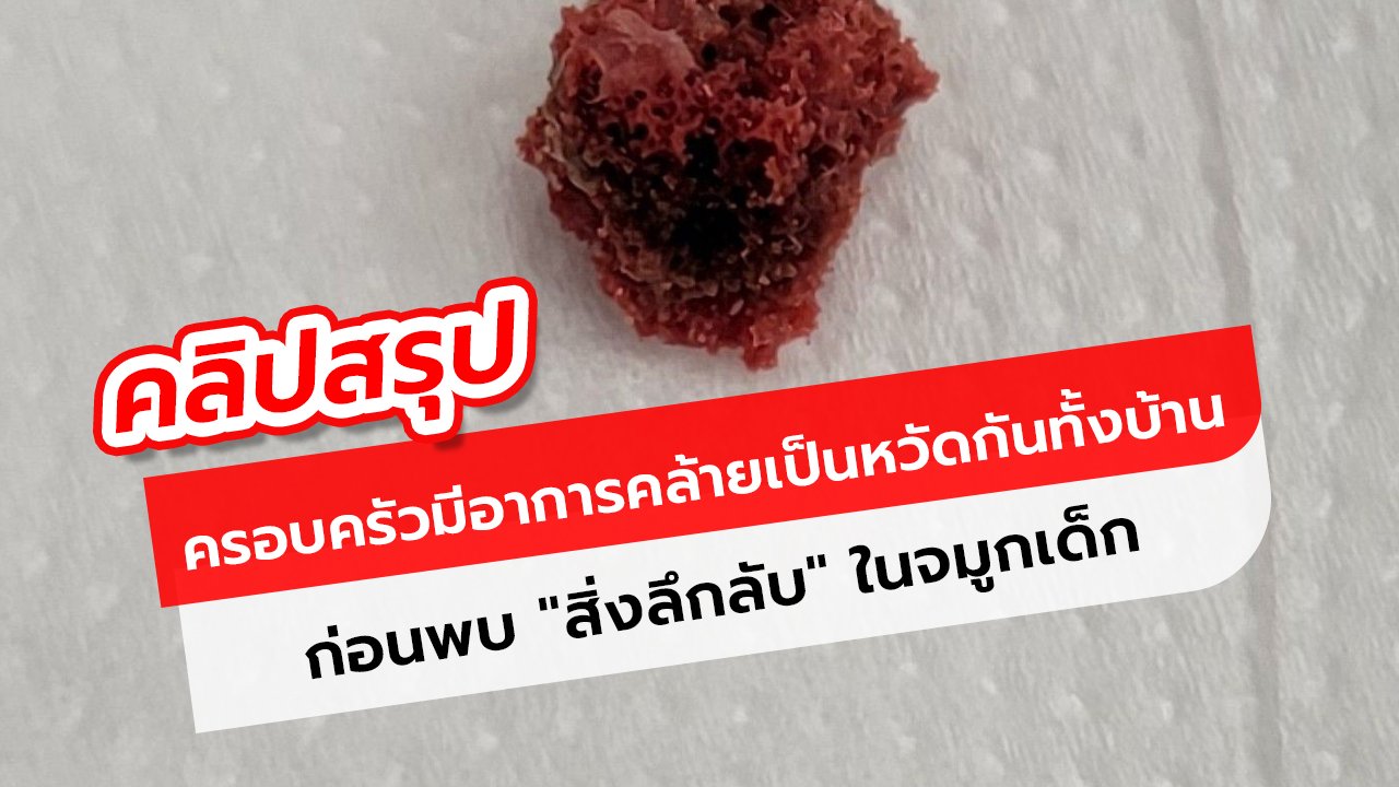 คลิป ครอบครัว 4 คน เป็นหวัด? หมอตรวจพบ 