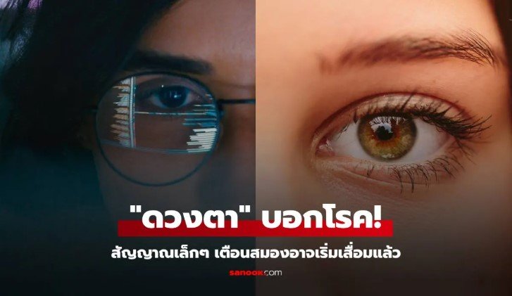 สัญญาณเตือนอัลไซเมอร์ผ่านดวงตา ตรวจสายตาอาจช่วยรู้ก่อนสมองเสื่อม 10 ปี