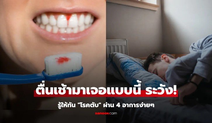 รู้ให้ทันก่อนสาย 4 อาการตอนเช้า อาจเป็นสัญญาณ โรคตับ ไม่ใช่เรื่องเล็ก ควรรีบพบแพทย์