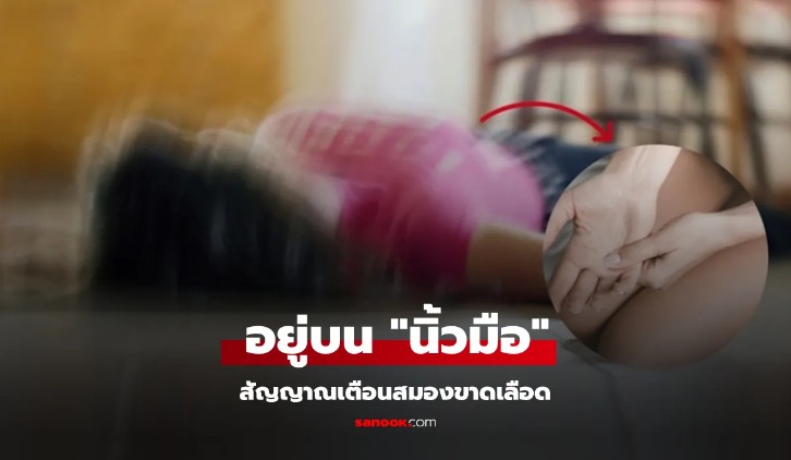 อย่ารอจนล้ม นิ้วมือ มี 2 สัญญาณเตือน ก่อนเกิดภาวะ สมองขาดเลือด อันตรายถึงชีวิต