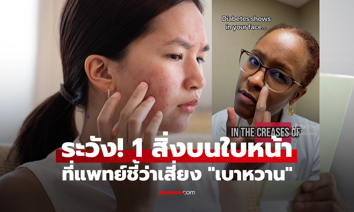 เผยสัญญาณบนใบหน้า ที่แพทย์ชี้ว่าเสี่ยง 