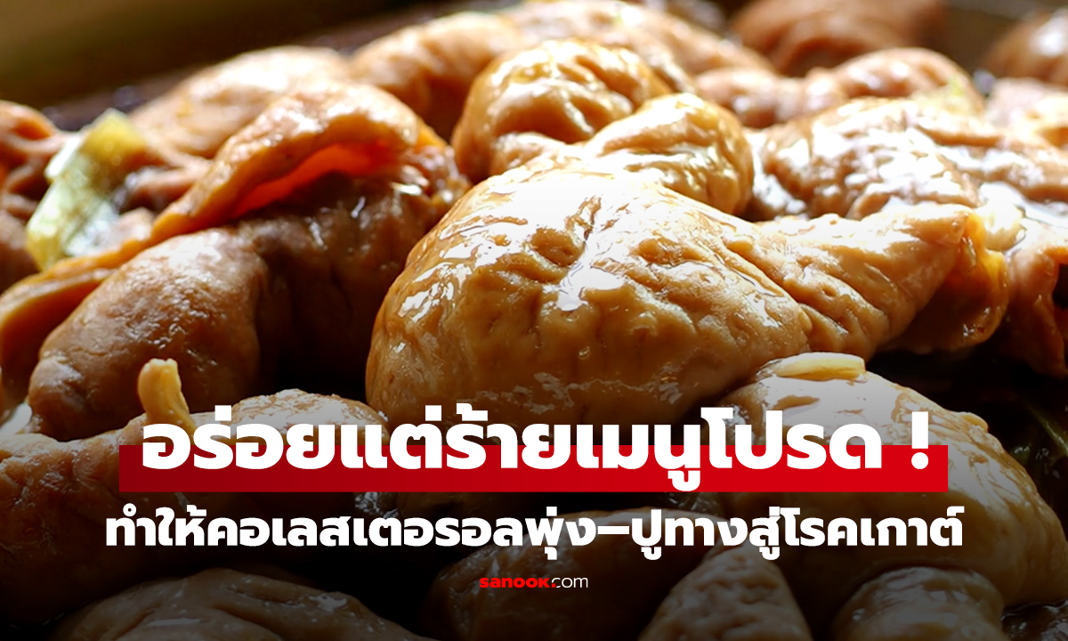 ตือนภัยเมนูโปรด ที่คอเลสเตอรอล 