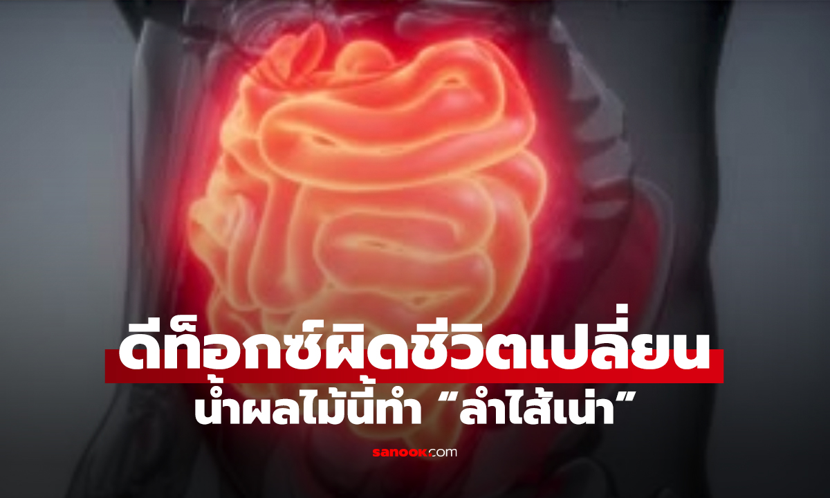 สาวหวังดีท็อกซ์ ดื่มน้ำผลไม้แค่วันเดียว! ลำไส้เน่า-ตัดไส้ใหญ่ทิ้ง หมอเตือนอย่าทำตาม!