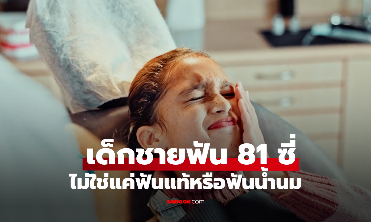 เด็กชายฟัน 81 ซี่ ไม่ใช่แค่ฟันแท้หรือฟันน้ำนม
