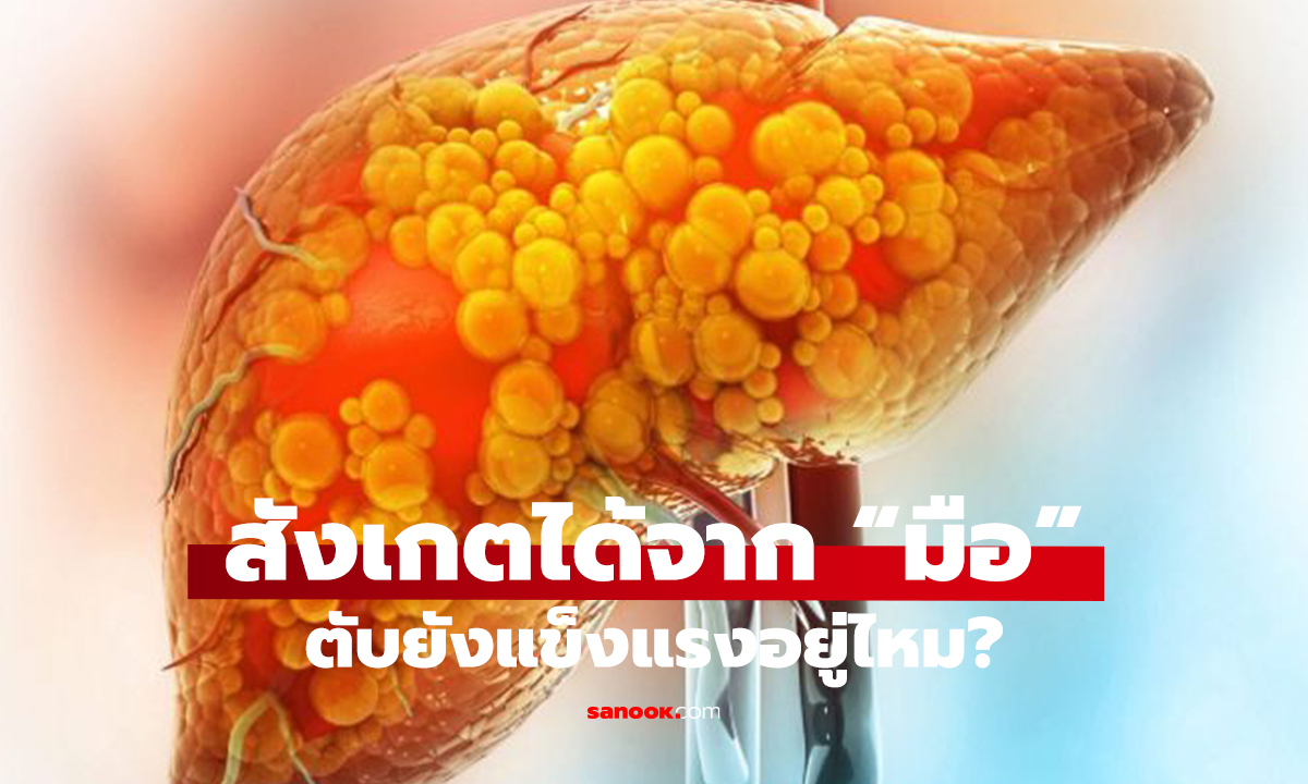 ดูที่มือ! สัญญาณบอกโรคตับ ปลายนิ้วมี 2 อาการนี้ รีบพบแพทย์ด่วน!