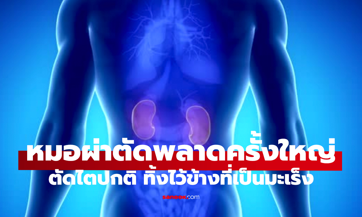ช็อกวงการแพทย์!   หมอตัดไตผิด เหลือข้างที่เป็นมะเร็ง