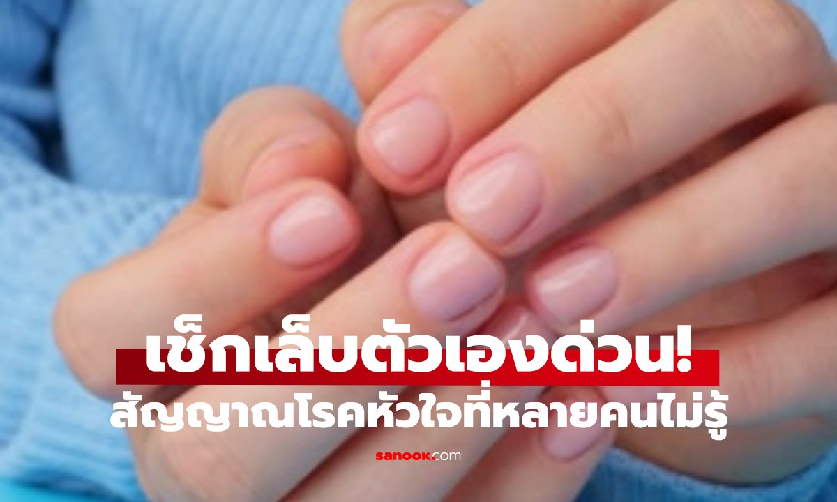 หมอเตือน! กดเล็บแล้วเจอสัญญาณนี้   รีบพบแพทย์ เสี่ยงโรคหัวใจร้ายแรง