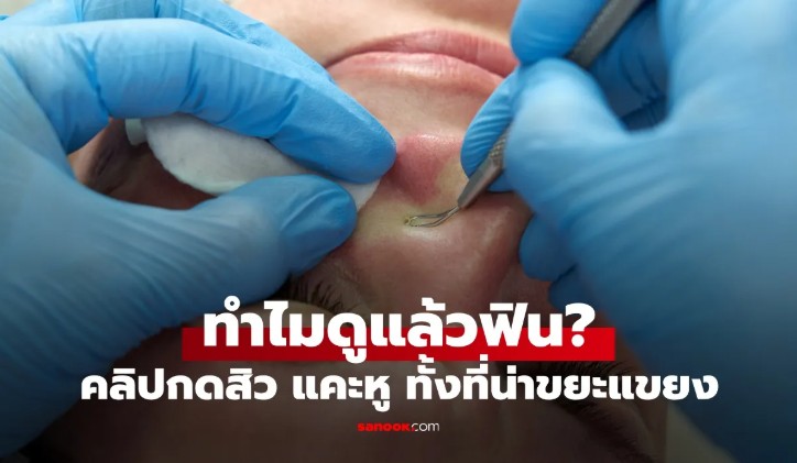 VOD_ ขั้นสุดของคลิปแคะหู เตือนไว้ก่อนว่าอย่าดูตอนกินข้าว