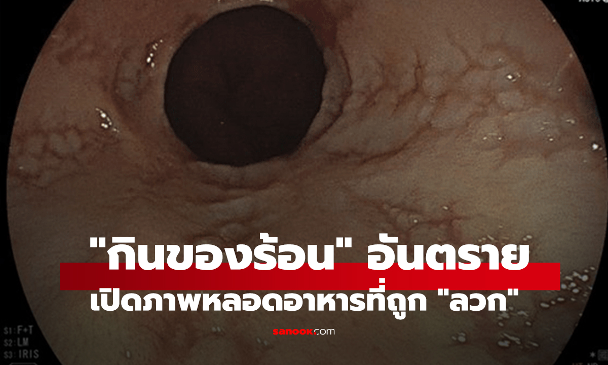 หมอเตือน 