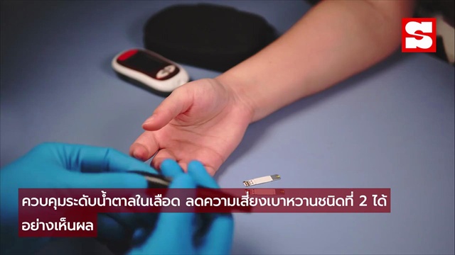 กินแอปเปิ้ลวันละลูก ผลลัพธ์สุดเซอร์ไพรส์! ร่างกายเปลี่ยนไป 6 อย่างแบบไม่รู้ตัว