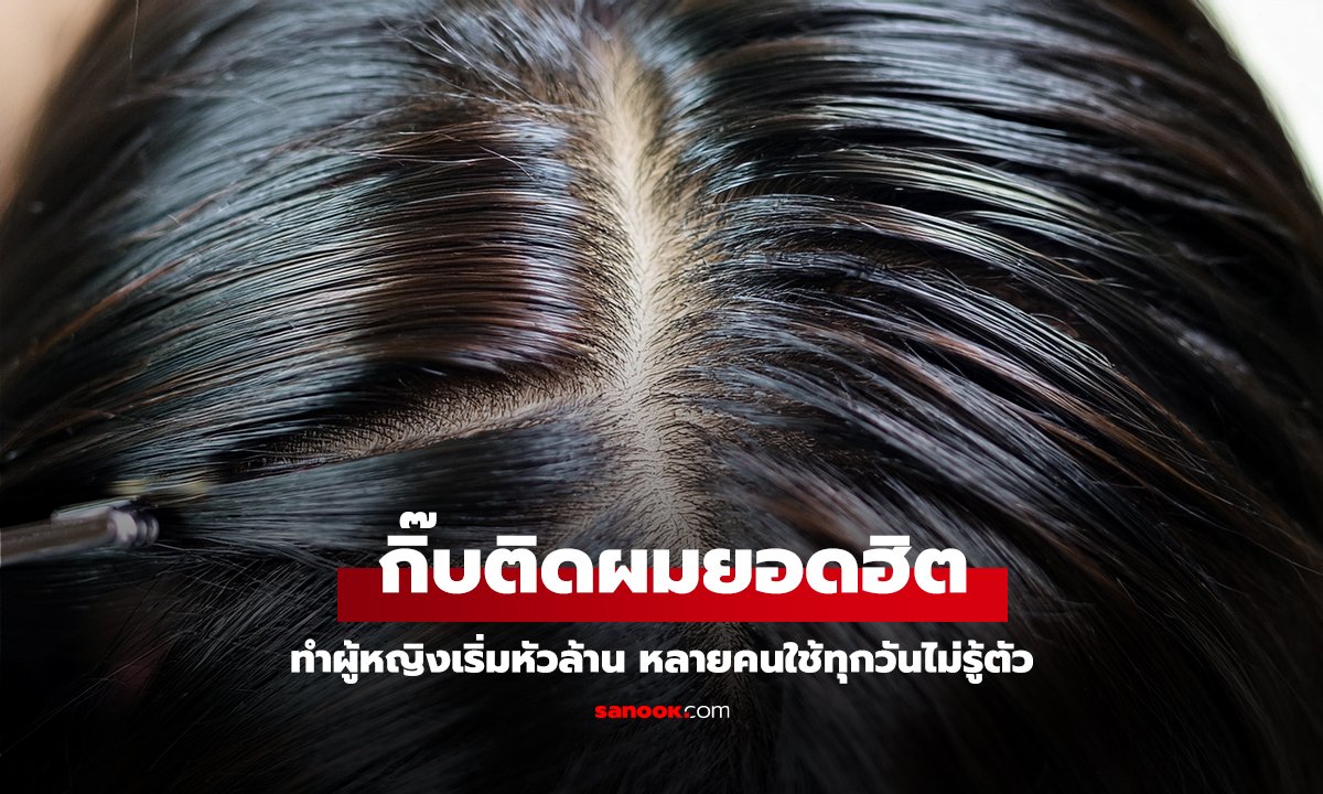 ผู้เชี่ยวชาญเตือน “กิ๊บติดผมยอดฮิต” ทำผู้หญิงเริ่มหัวล้าน หลายคนใช้ทุกวันไม่รู้ตัว