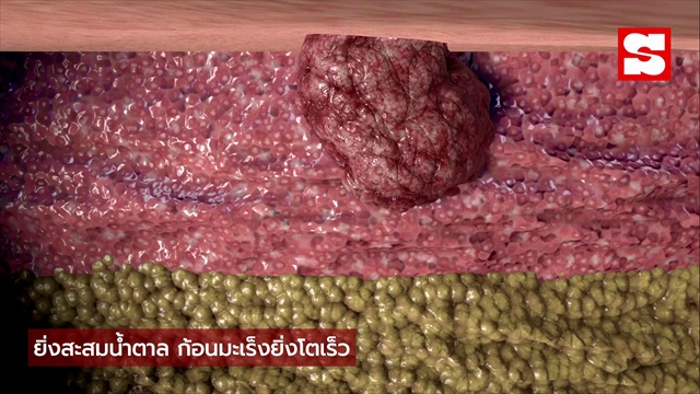 เจอตัวการแล้ว! สิ่งที่แอบ 