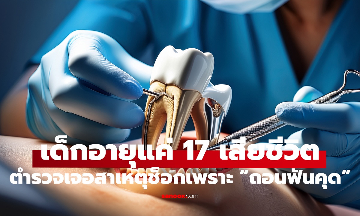ถอนฟันคุด ดับชีวิต! เด็ก 17 ตายทั้งที่ไม่ควรตาย