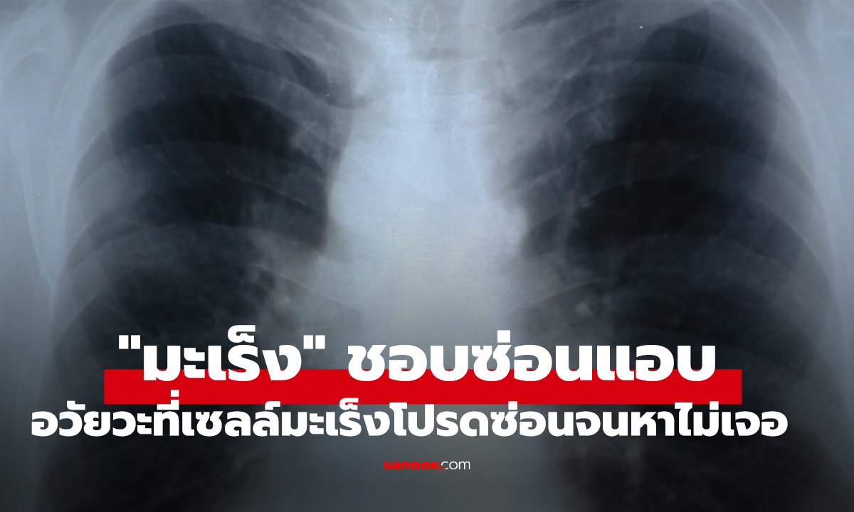 เช็กด่วน! 5 อวัยวะที่เซลล์มะเร็ง "โปรดปราน" ซ่อนเก่งจนหาไม่เจอ รู้อีกทีก็ลามหนัก