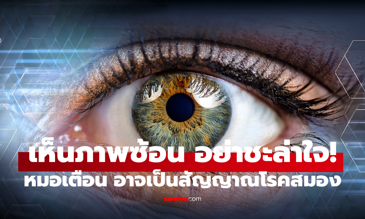 จู่ ๆ เห็นภาพซ้อน อย่าชะล่าใจ! หมอเตือน อาจเป็นสัญญาณโรคสมอง