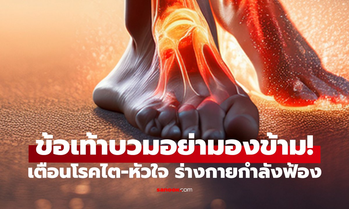 สัญญาณที่ข้อเท้า อย่ามองข้าม! เตือนโรคไต-หัวใจ ร่างกายกำลังฟ้อง