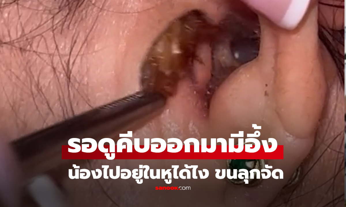 คลิป น้องไปอยู่ในหูได้ไง ขนลุกจัด!!