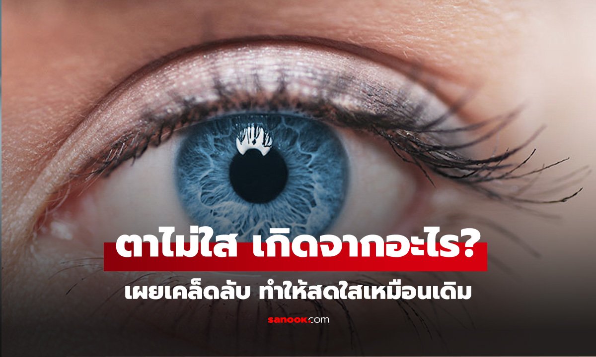 ตาขาวไม่ใส เกิดจากอะไร? เผยเคล็ดลับง่ายๆ ทำให้กลับมาสดใสเหมือนเดิม