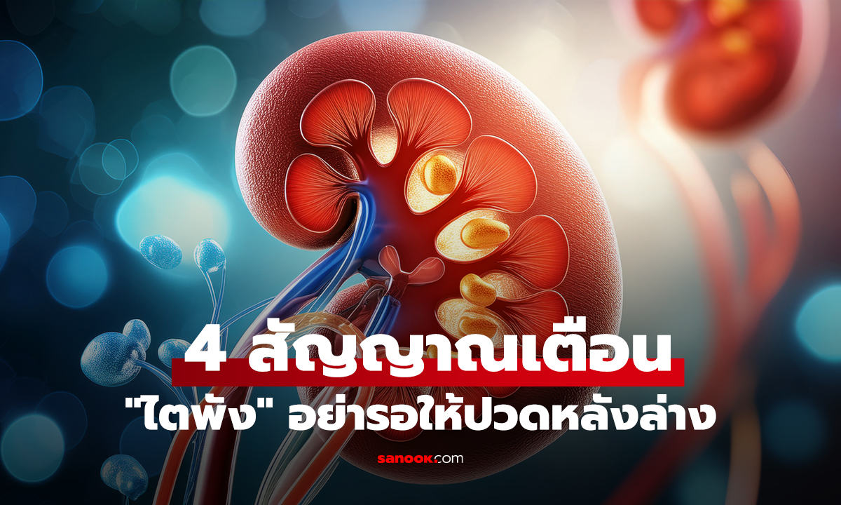 4 สัญญาณเตือน 
