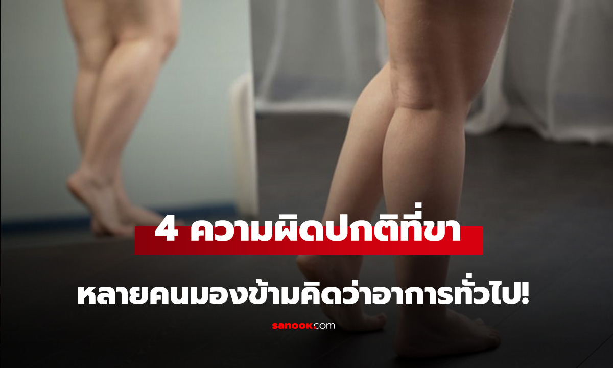 หมอเตือน 4 ความผิดปกติที่ 