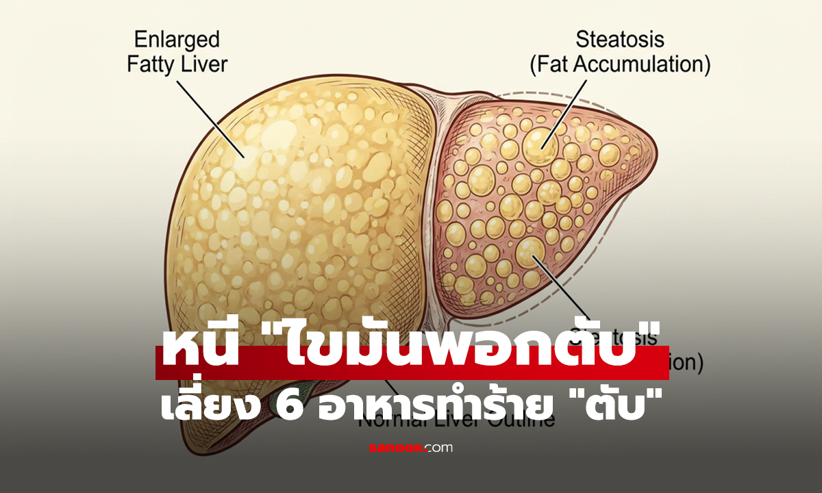 หนี 