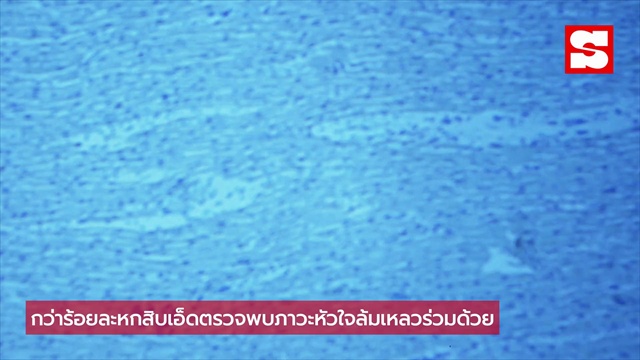 สังเกตด่วน 