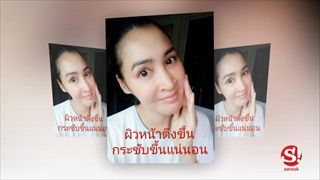 เปลี่ยนหน้าพังให้ใสวิ้ง! ษา วรรณษา เผยเคล็ดลับรักษาสิวหายเกลี้ยง ด้วยน้ำแข็ง