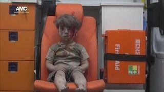 สะเทือนใจ ลูกหลง เด็กชาย Aleppo เหตุระเบิดในซีเรีย คนทั่วโลกช่วยแชร์