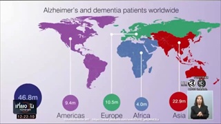 ผู้ป่วยอัลไซเมอร์มีความหวัง ! เมื่อสหรัฐฯพบวิธีรักษาอัลไซเมอร์