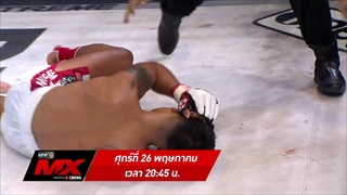 ตัวอย่าง MX MUAY XTREME | 26 พ.ค. 60 | one 31