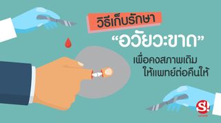 วิธีเก็บรักษา “อวัยวะขาด” เพื่อคงสภาพเดิม-ให้แพทย์ต่อคืนให้