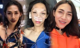 ลุคนี้ปัง! ฟลุ๊ค กะล่อน ศัลยกรรมทำสวย เปลี่ยนหน้าหนวด เป็นหน้าหวาน