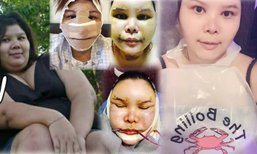 ทุ่ม 5 ล้าน! ศัลยกรรมเกาหลีเปลี่ยนชีวิตสาวอ้วนให้ดูดีขึ้น