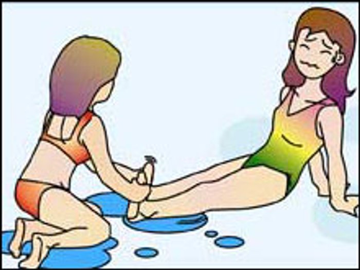 เป็นตะคริว Muscle Cramps