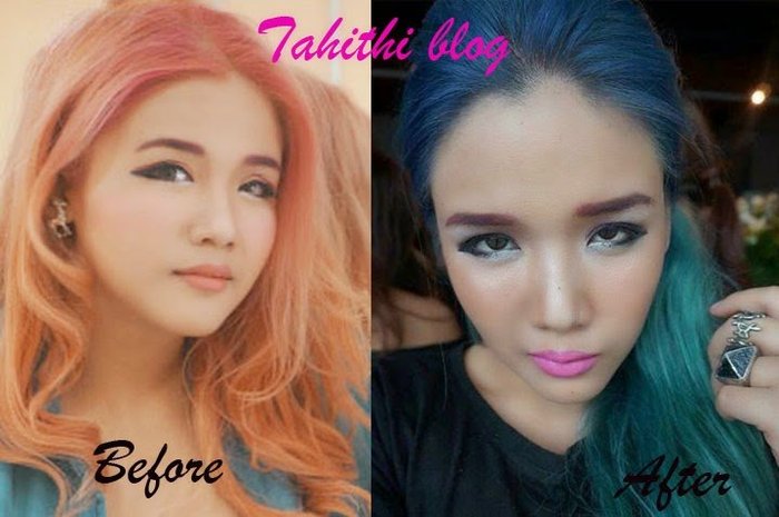 Review: ทำหน้าเรียว BOTOX+V Shape สวยจริงแบบไม่ต้องพึ่ง App
