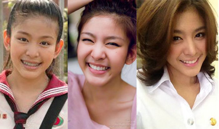 ทำไมเค้าถึงว่า "หนูนา" ศัลยกรรม
