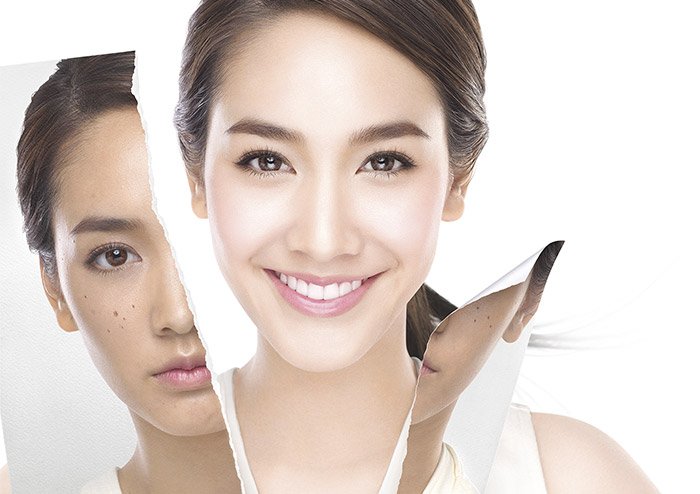 ฉีกกฏ แห่งการจัดการจุดด่างดำ สู่ความกระจ่างใสถึงขีดสุด